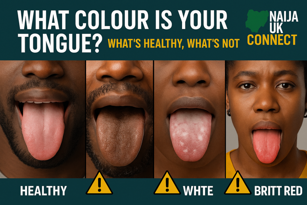 👅 What Colour Is Your Tongue? What’s Healthy, What’s Not