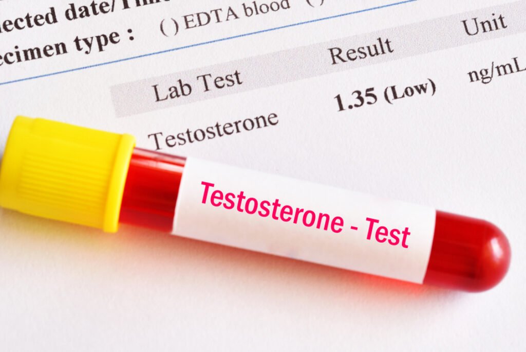 Low Testosterone Symptoms: What Nigerian Men in the UK Should Know
