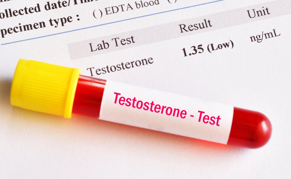 Low Testosterone Symptoms: What Nigerian Men in the UK Should Know
